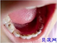 到底什么是口腔疾病呢