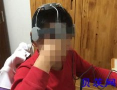 医院做一次经颅磁刺激仪多少钱