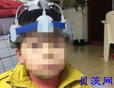 家用版经颅磁刺激仪